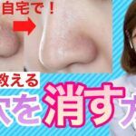 【女医が教える】自宅で毛穴を消す方法🌟