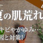 【夏の肌荒れ】原因は汗？ニキビやかゆみを防ぐスキンケア対策〔#95〕