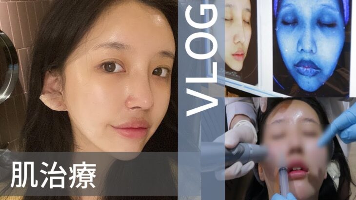 【韓国毛穴レス】韓国女子の美容皮膚科でのスキンケアを教えます♡