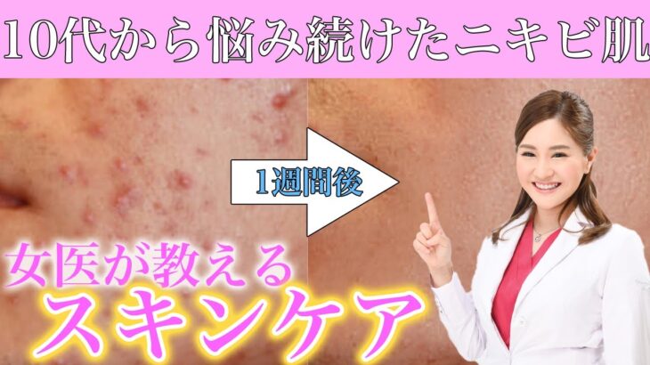 【ニキビ肌必見】美容外科医が徹底解説！1週間で美肌になる方法✨【克服法・正しいスキンケア】