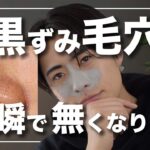 【毛穴】たった1日で毛穴黒ずみをなくす方法教えます