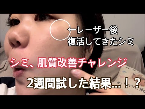 美白スキンケア♡ガチでシミに効いた！2週間チャレンジ！