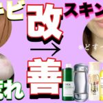 【スキンケア】コロナ禍のマスクニキビ・肌荒れ改善！スキンケア紹介！