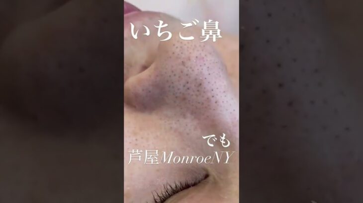 毛穴エクストラクションモンロー式 #毛穴 #エクストラクション #毛穴エクストラクション #extractions #blackhead #satisfying #esthetician #マ