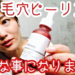 【the ordinary ピーリング】正直レビュー&誰もお伝えしていないであろう注意すべき事