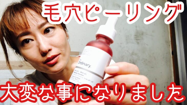 【the ordinary ピーリング】正直レビュー&誰もお伝えしていないであろう注意すべき事