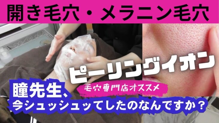 【開き毛穴】メラニン毛穴ピーリングイオンでツルスベ美肌★お家でできる裏技公開★