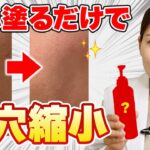 【手遅れになる前に】本気で黒ずみ毛穴治したい人へ! 毛穴の黒ずみが消える最強スキンケア【角栓・ざらつき・くすみ解消】