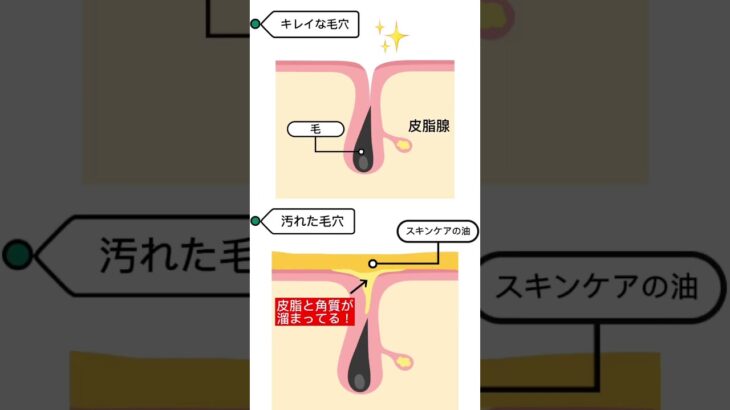 【スキンケア】正しいケアできてますか？🥹　#shorts #角栓 #毛穴 #いちご鼻 #ニキビ