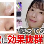 【開き毛穴とサヨナラ】ダーマレーザー美容液が毛穴に効果抜群でした【ウルセラC･R・スキンケア・毛穴レス】