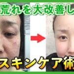 【マネしやすい】美容のプロが教えるスキンケア方法！シミ・シワ対策万全！