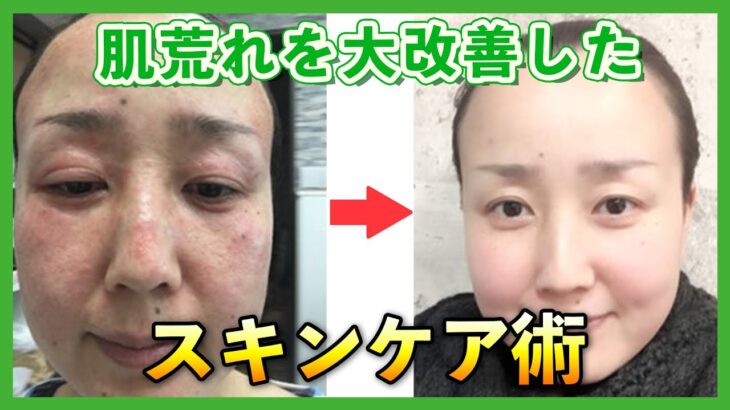 【マネしやすい】美容のプロが教えるスキンケア方法！シミ・シワ対策万全！