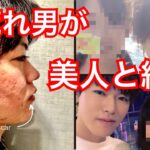 【ニキビ】超絶！肌荒れ男が１５年かけて美人妻と結婚出来た軌跡「スキンケアvlog」