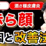 赤ら顔（酒さ・酒さ様皮膚炎）の悪化原因と改善する方法（スキンケア・治療・レーザーetc）