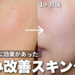 【赤ら顔の治し方】赤み改善したプチプラスキンケアをご紹介します！！