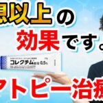 【アトピーの治療薬】　コレクチム軟膏の効果と使い方。ステロイドなどの既存薬との違いとは？