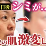 【検証】スキンケアで肌は綺麗になるのか！？100日後美肌になる44歳！肌質改善ドキュメンタリーがスタート♪【#1】