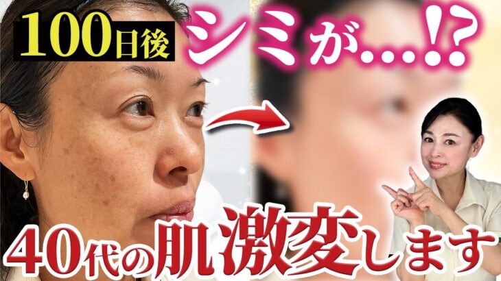 【検証】スキンケアで肌は綺麗になるのか！？100日後美肌になる44歳！肌質改善ドキュメンタリーがスタート♪【#1】