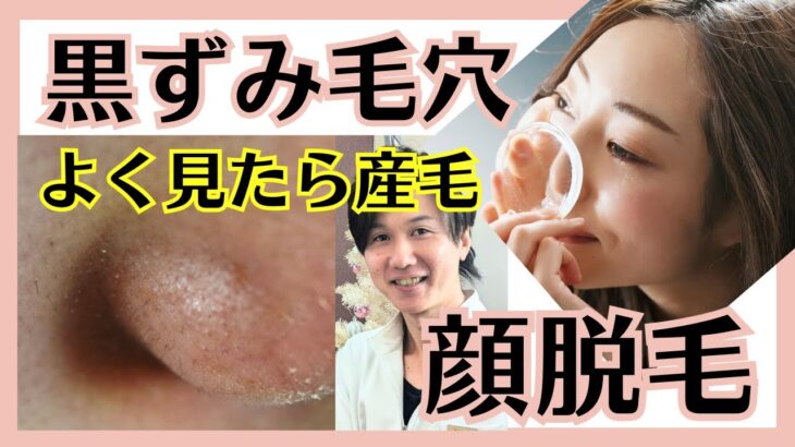 【黒ずみ毛穴】【やばい】もしかして毛穴から毛生えてる？？？