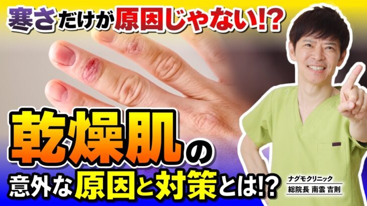 【必見】乾燥肌対策したいなら、家中の洗剤を〇〇〇に替えてください！（スキンケア・洗剤・粉吹き・保湿・化粧水・ナグモクリニック・予防医療）