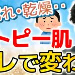 【肌質改善】アトピー肌を変える方法と大事な視点