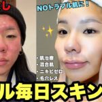 【垢抜け】ニキビ肌からNOトラブル肌になったリアル毎日スキンケアを案件なしで全部見せ！【スキンケア編】