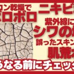 【紫外線だけじゃない！】夏の肌荒れの原因とスキンケア方法を解説！