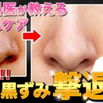 【いちご鼻】毛穴に有効なスキンケア成分と自宅でできる黒ずみケアを皮膚科医が解説