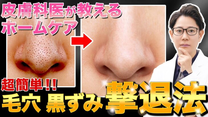 【いちご鼻】毛穴に有効なスキンケア成分と自宅でできる黒ずみケアを皮膚科医が解説