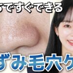 【いちご鼻から卒業】おうちでできる、鼻の毛穴の黒ずみを撃退する方法を美容のプロが解説