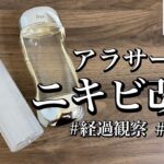 【ニキビを治す方法】長年のニキビの悩みこれで解消【イプサ】【肌荒れ改善】【スキンケア】【美肌】【ニキビ跡】