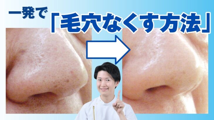 【黒ずみ毛穴を撲滅】犯人はオイルが入った化粧品！毛穴が目立つ原因と効果的な改善方法を教えます！