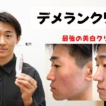 【美白】デメランクリームの効果と使い方！毛穴・ニキビ跡・ニキビ・シミ・クレーターに塗ってみた経過がヤバい。