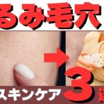 【たるみ毛穴】美容が好きな大人女性へ！お家のスキンケアで肌質改善＆専門店にお任せください