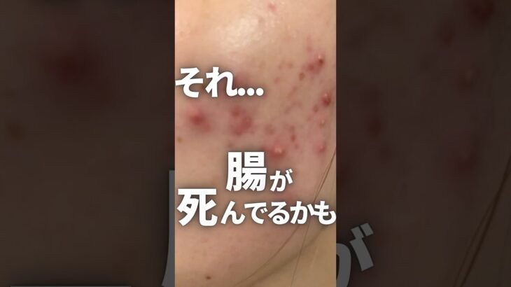 肌荒れ改善のために腸活やってる人へ… #ニキビ #スキンケア #インナーケア