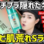 【正直レビュー】ニキビや肌荒れでスキンケアに悩む脂性肌必見。大人気のプチプラ化粧水をご紹介するぞ（トラブルケア）