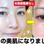 【冬スキンケア】毛穴も肌荒れもひどかった私が圧倒的美肌を手に入れたスキンケアルーティン【乾燥肌】