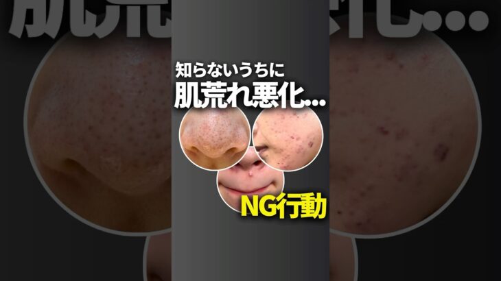 肌荒れが加速する…！NG行動🙅‍♀️#ニキビ  #スキンケア #ニキビケア