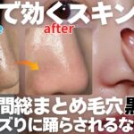 【毛穴ケアまとめ】本気スキンケア！長年の毛穴悩みを解消させるバズりに踊らされるのは終わり!